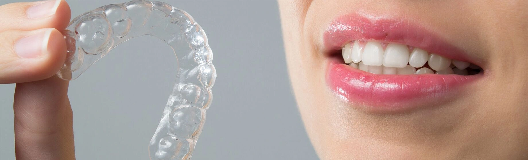 Invisalign Treatment in Roanoke